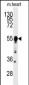 BACE1 Antibody (N-term)